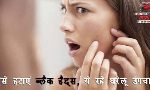 जानिए, ब्लैक हैड्स से छुटकारा पाने का सर्वोत्तम घरेलू उपचार