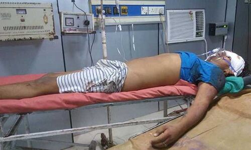 पटना: अपराधियों ने पत्रकार के बेटे को दिन-दहाड़े मारी गोली, हालत गंभीर