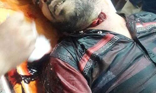 चाइनीस मांझे ने ली फिर एक की जान