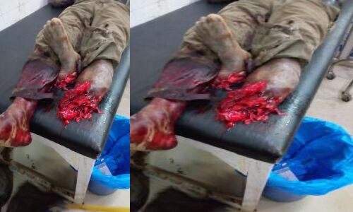 झांसी के बाद अब यूपी के सुल्तानपुर में डाक्टरों की इंसानियत शर्मसार