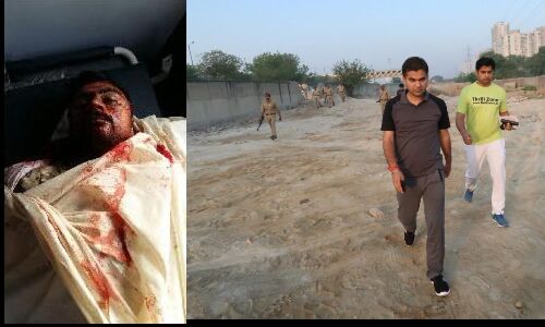 नॉएडा पुलिस ने किया एक लाख का इनामिया बदमाश मुठभेड़ में ढेर