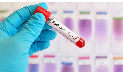 सावधान: निपाह वायरस से खुद को ऐसे बचाएं, जानें कैसे फैलता है इसका संक्रमण सावधान: निपाह वायरस से खुद को ऐसे बचाएं, जानें कैसे फैलता है इसका संक्रमण