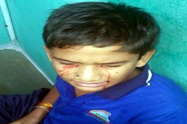 खून के आंसू रोता है 13 साल का ये बच्चा, डॉक्टर भी है हैरान खून के आंसू रोता है 13 साल का ये बच्चा, डॉक्टर भी है हैरान